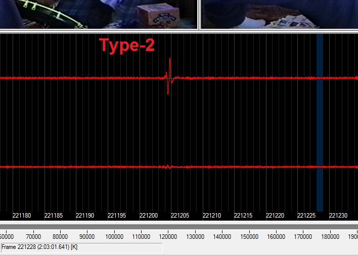 Click image for larger version

Name:	DV type-2 - bad sync - f221228 crop.png
Views:	3575
Size:	81.8 KB
ID:	35596